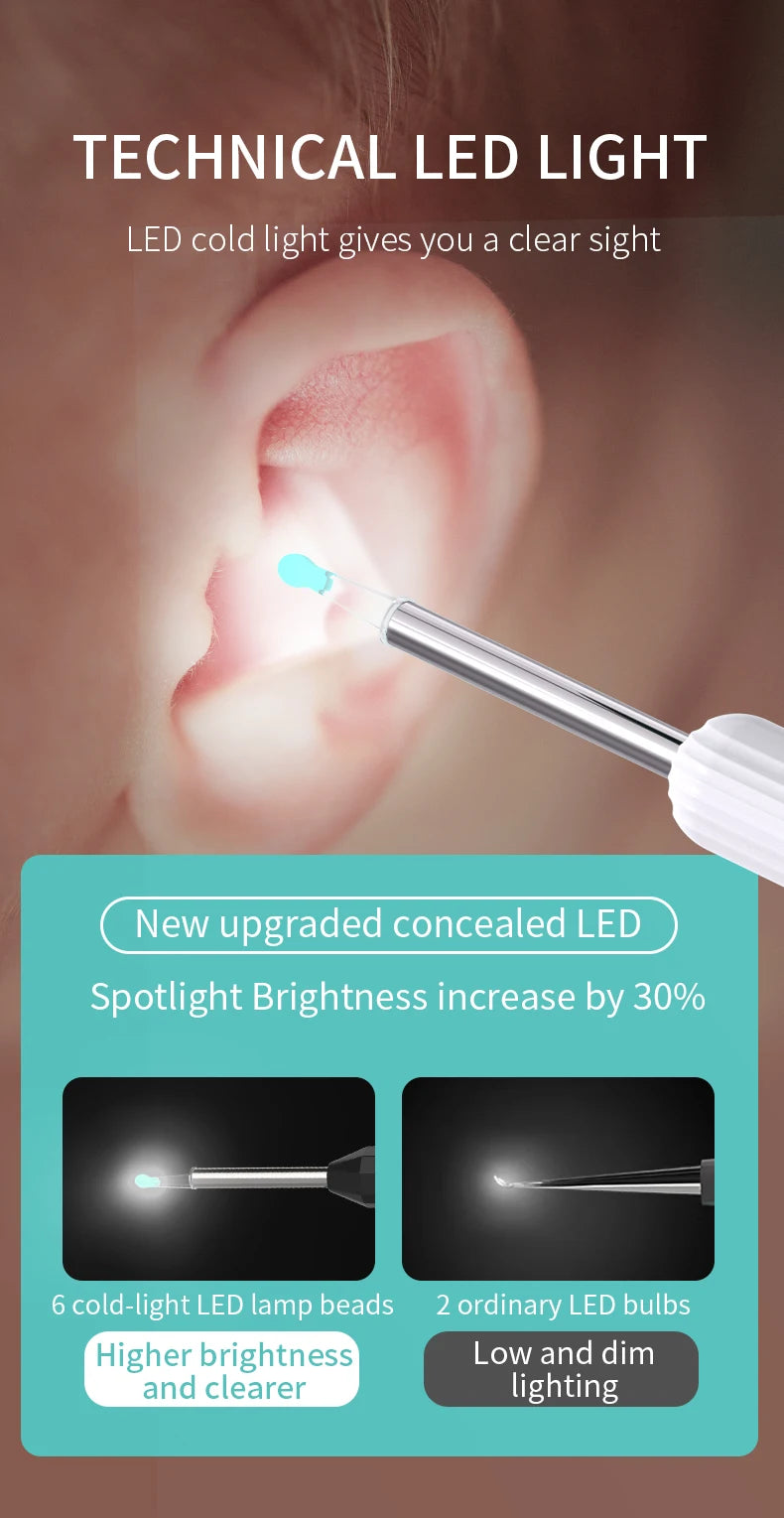 Nettoyeur d’oreilles intelligent avec caméra – Retrait du cérumen en toute sécurité